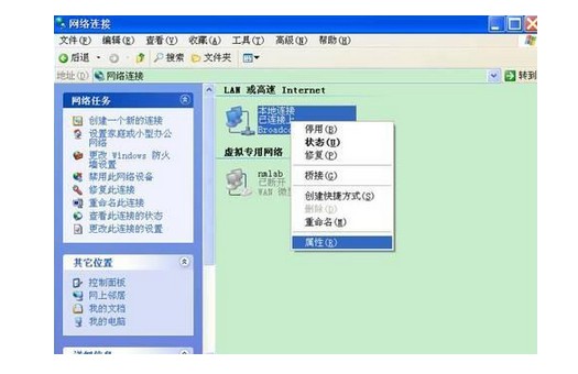 3-选择“本地连接”